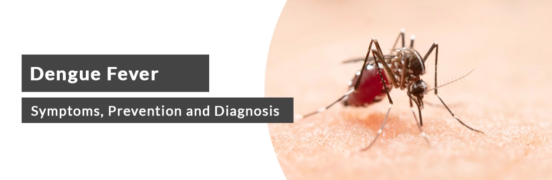 Dengue Fever : Symptoms, Prevention and Diagnosis